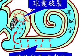 张学友舞台跌倒事件，专家解析耳石危象的隐藏危机与预防